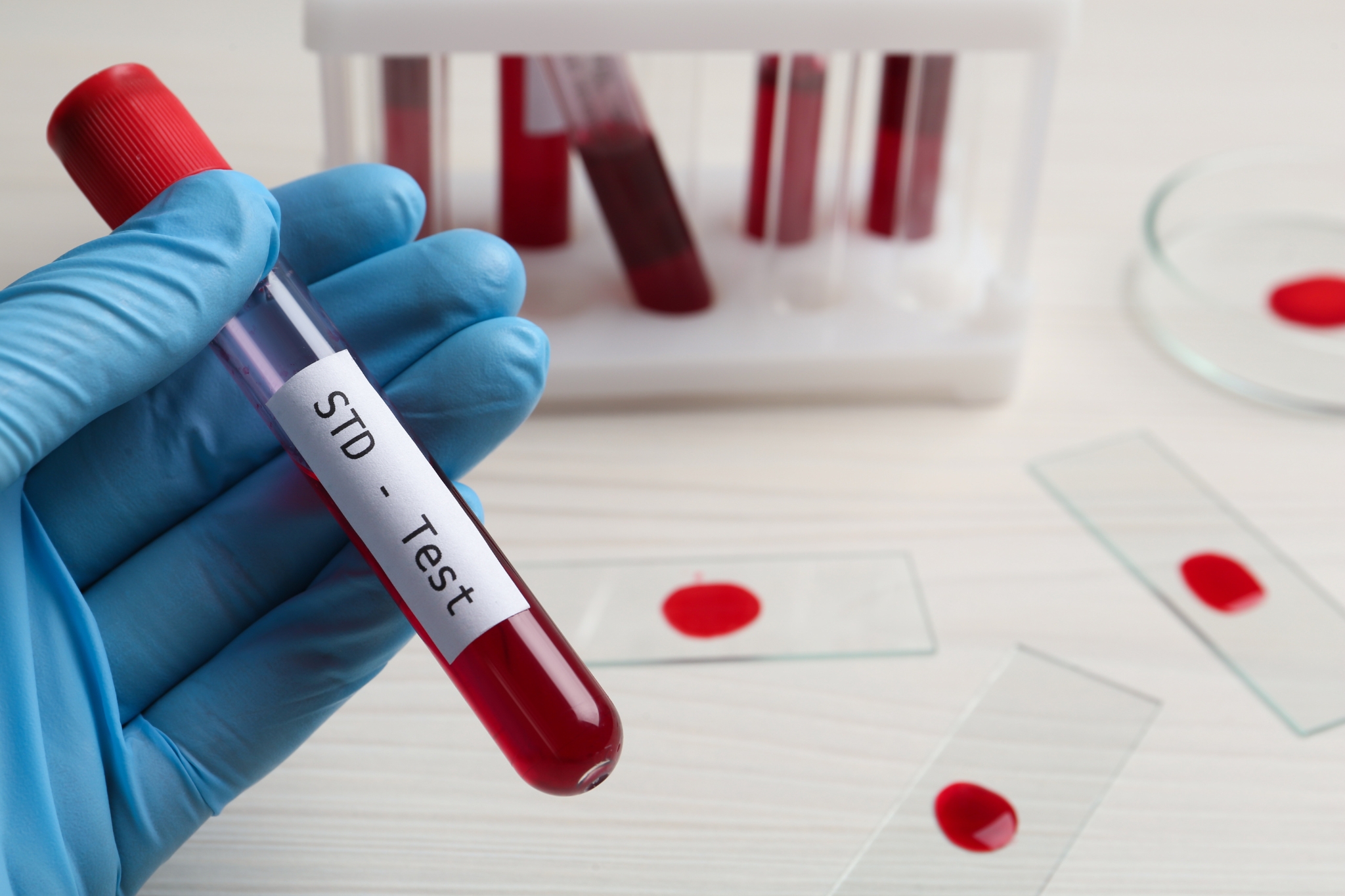STD Test